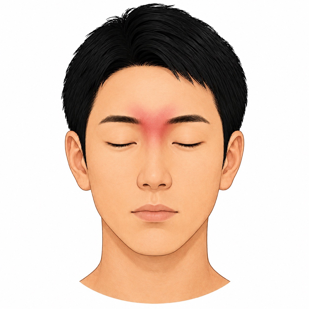 眉間
