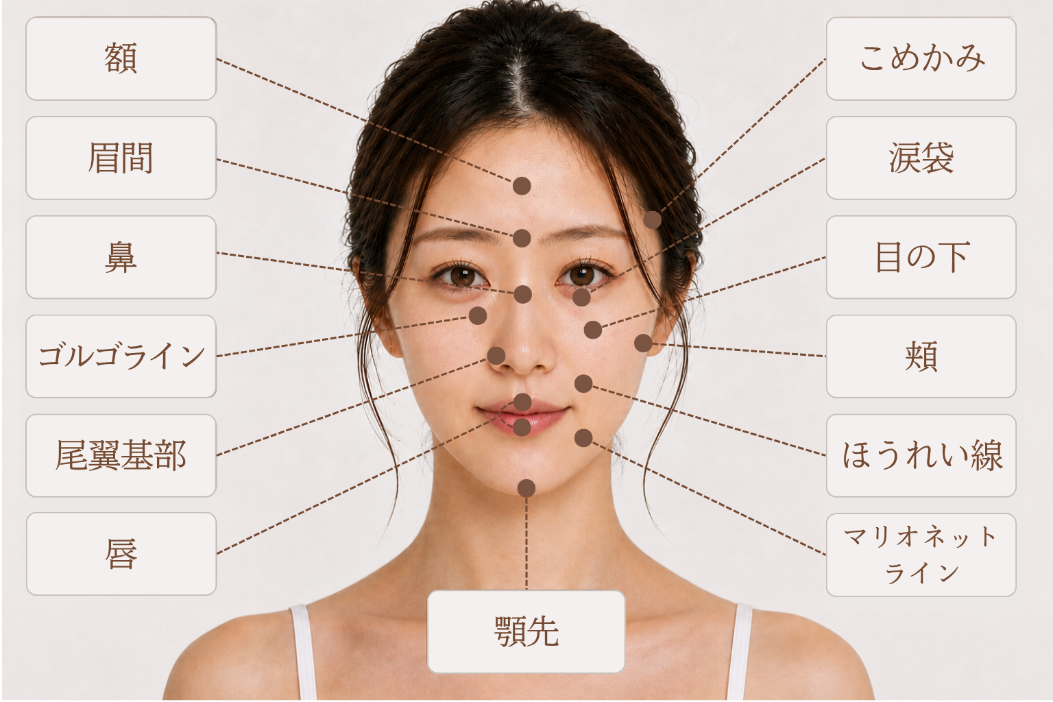 ヒアルロン酸を注入できる主な箇所（女性）