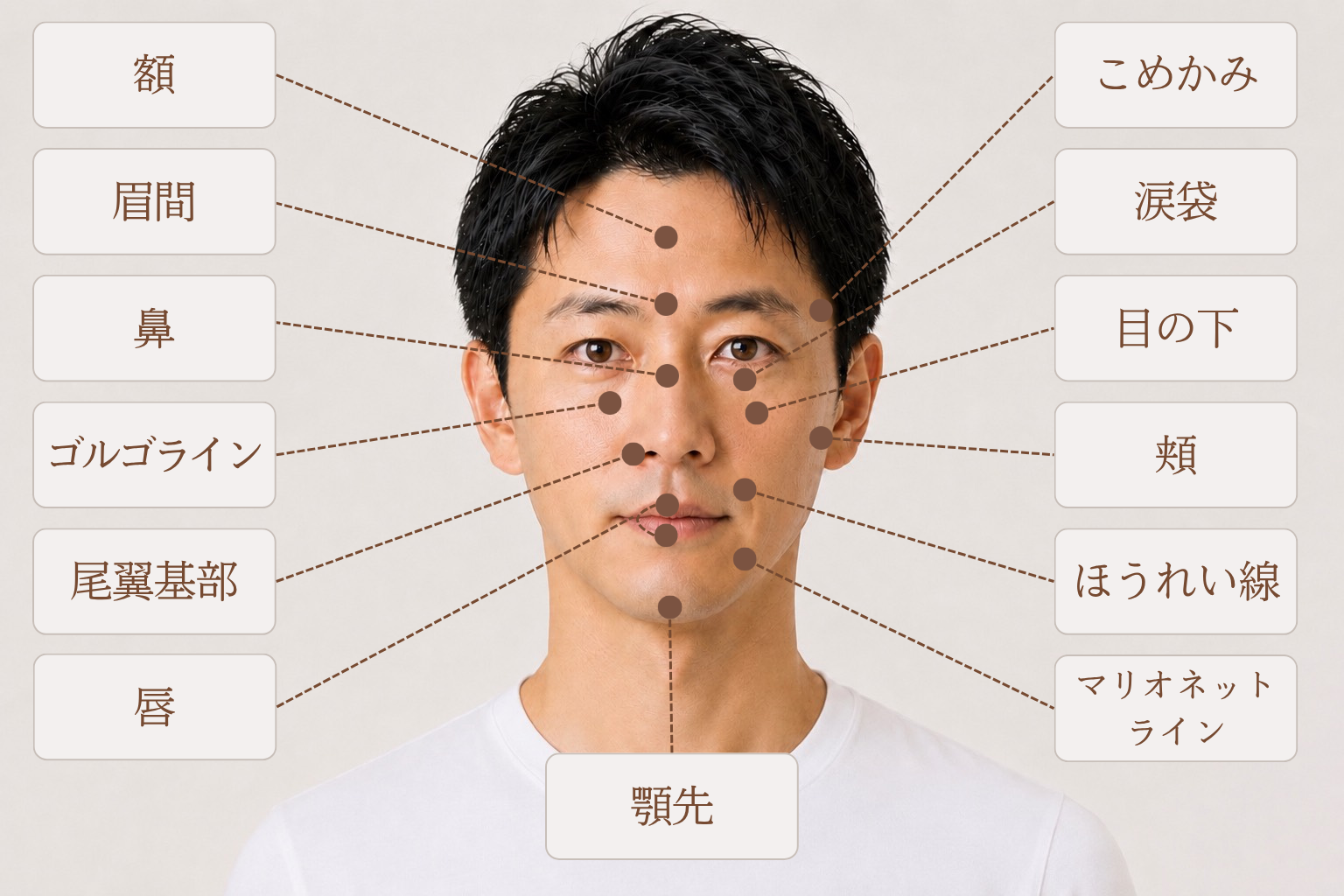 ヒアルロン酸を注入できる主な箇所（男性）