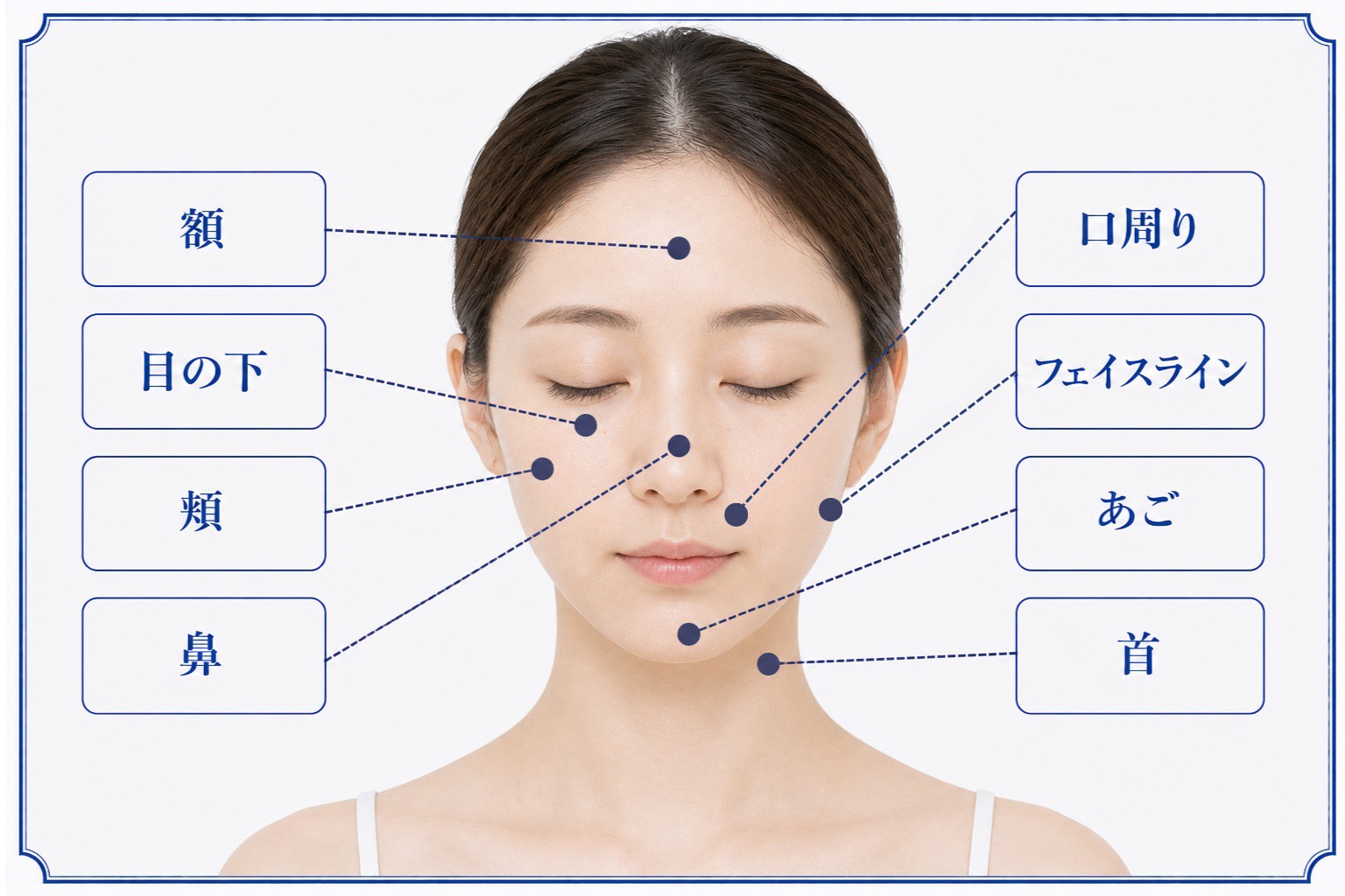 肌治療ができる主な箇所（女性）