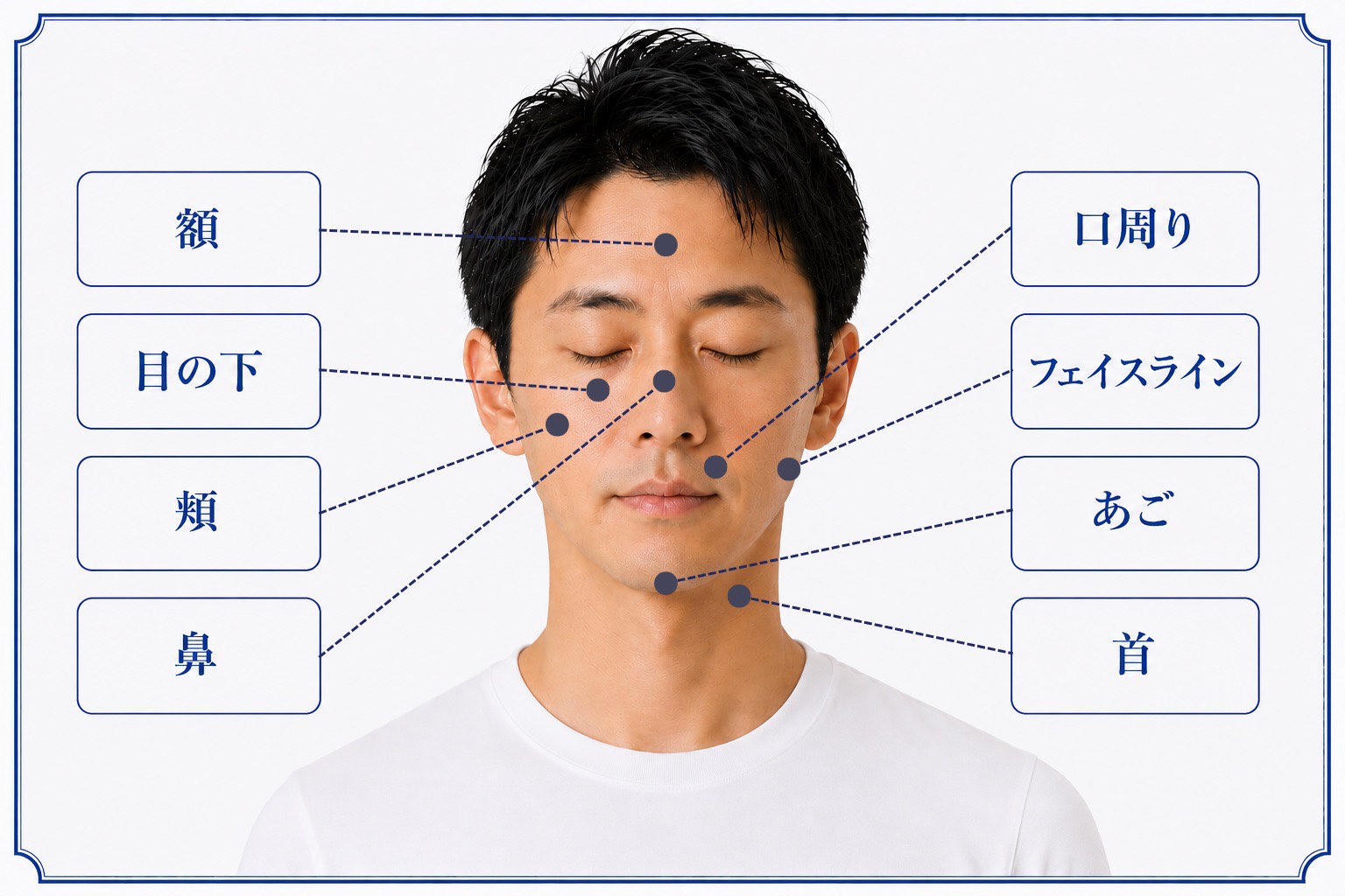 肌治療ができる主な箇所（男性）